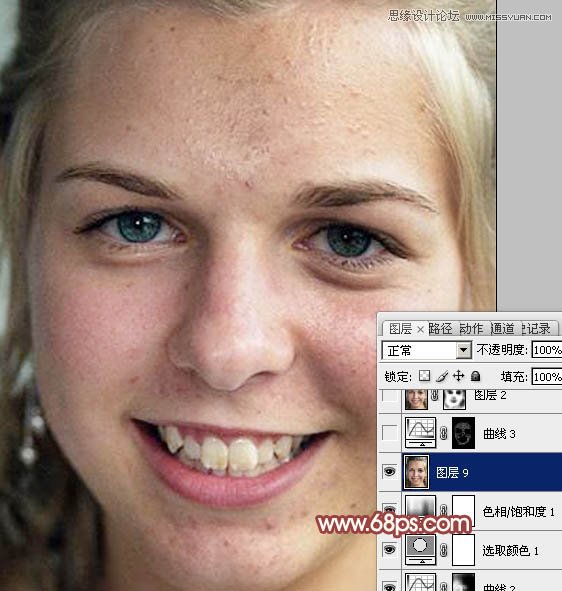 Photoshop使用通道法给满脸雀斑的女人磨皮11