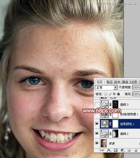 Photoshop使用通道法给满脸雀斑的女人磨皮8
