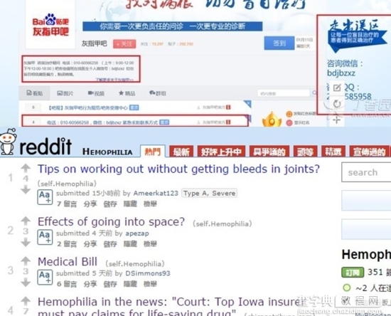 易评：百度贴吧和Reddit究竟有什么不一样2