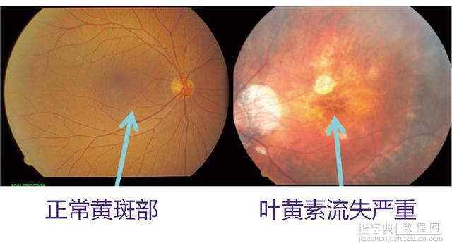 护眼显示器有用吗 护眼显示器效果介绍4