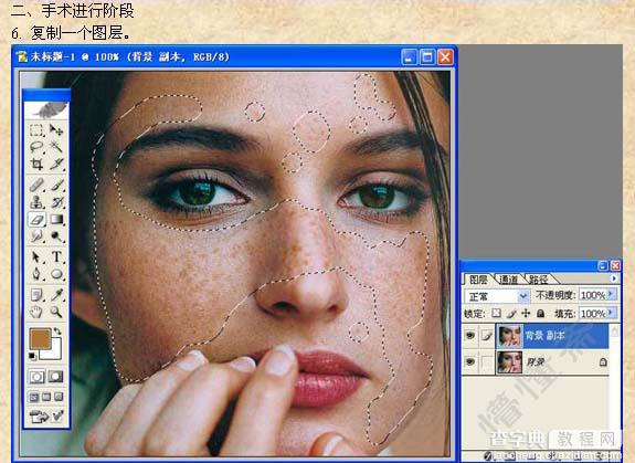 photoshop 快速消除人物脸部雀斑并还原皮肤质感6