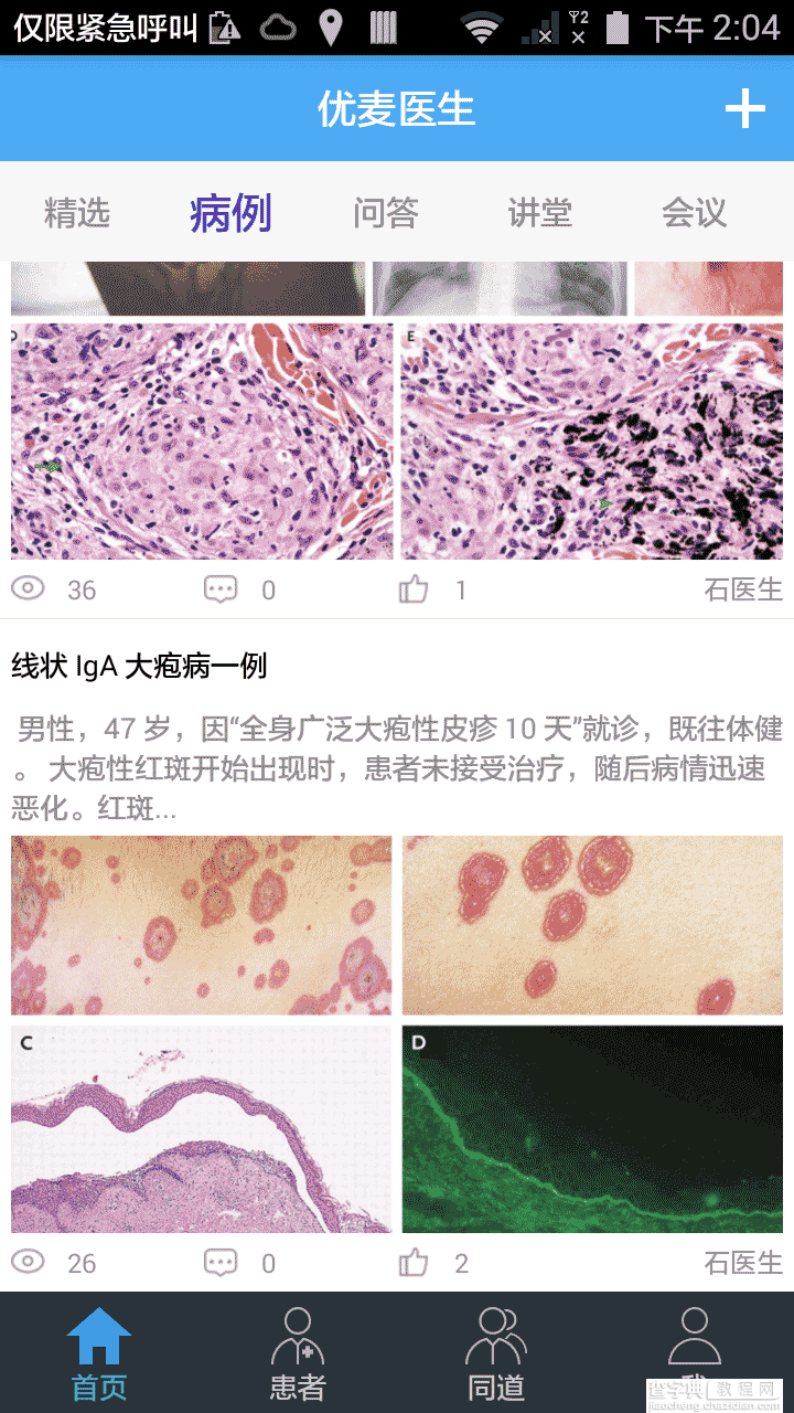 Android listview多视图嵌套多视图2