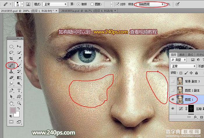 Photoshop利用通道完美消除人物脸部的雀斑并还原肤色细节40